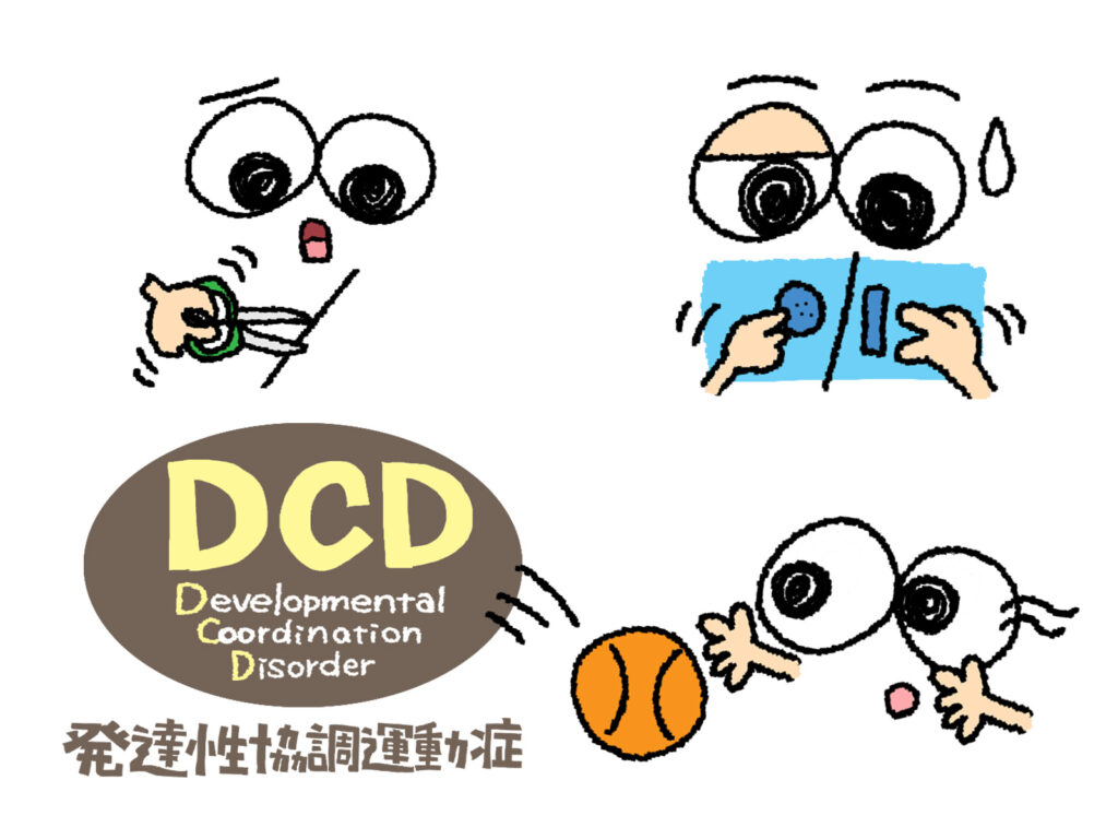 発達性強調運動症（DCD）とビジョントレーニング